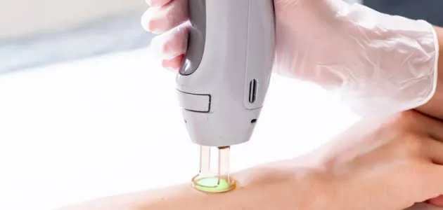 عيادات الليزر في عمان الاردن
