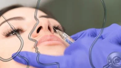 أفضل دكتور تجميل انف في عمان