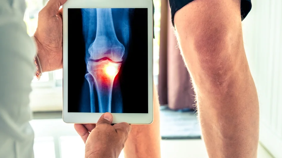 أعراض مشاكل الركبة