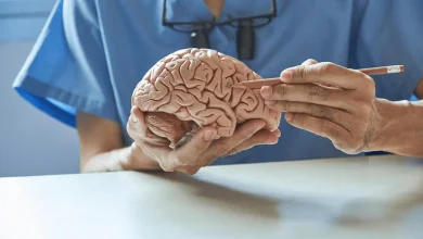 أفضل دكتور مخ وأعصاب في عمان