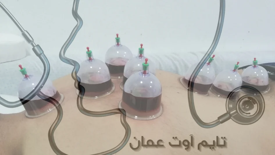 مركز عيد للحجامة والطب البديل